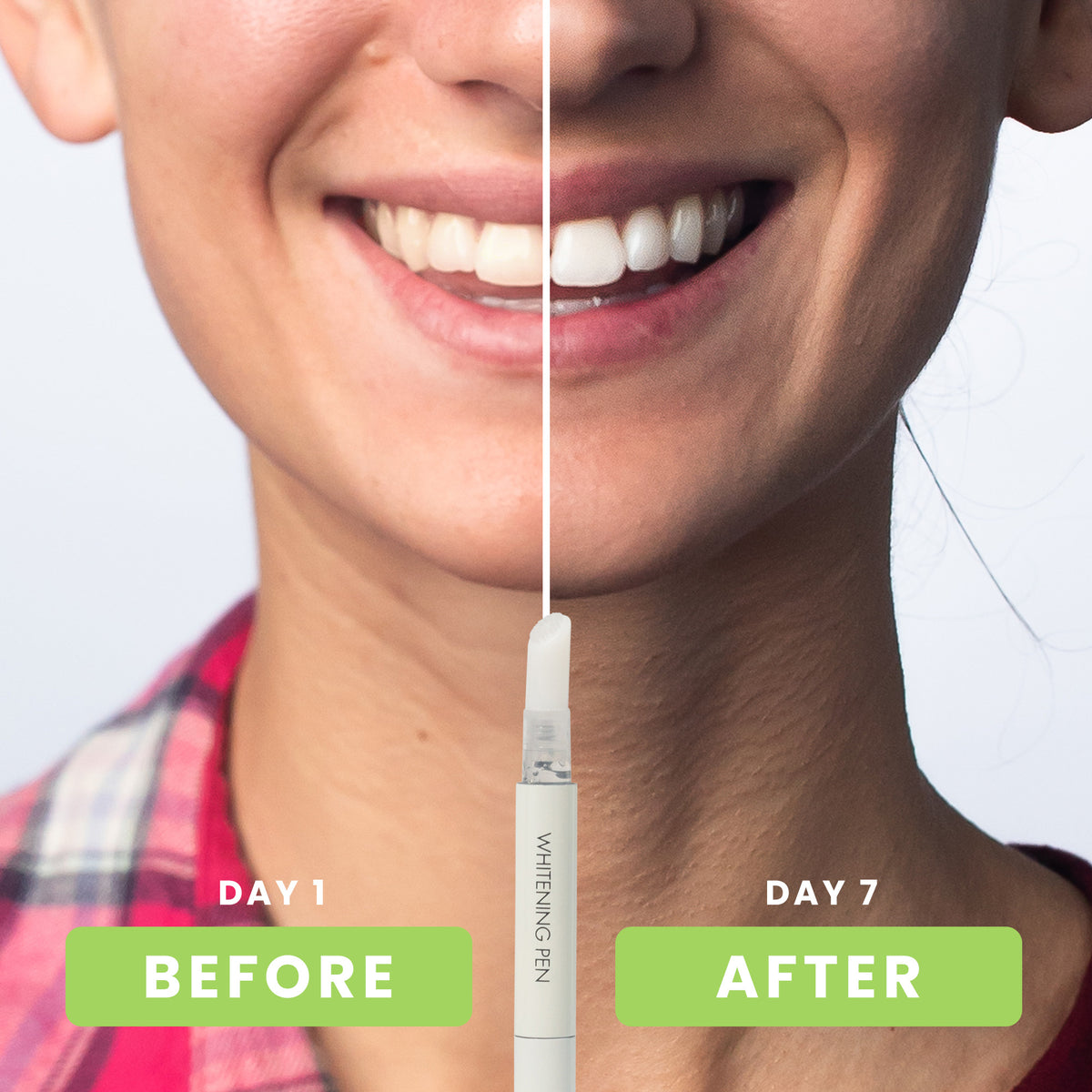 NEW Wireless Advanced Whitening System (With Hydrogen Peroxide)