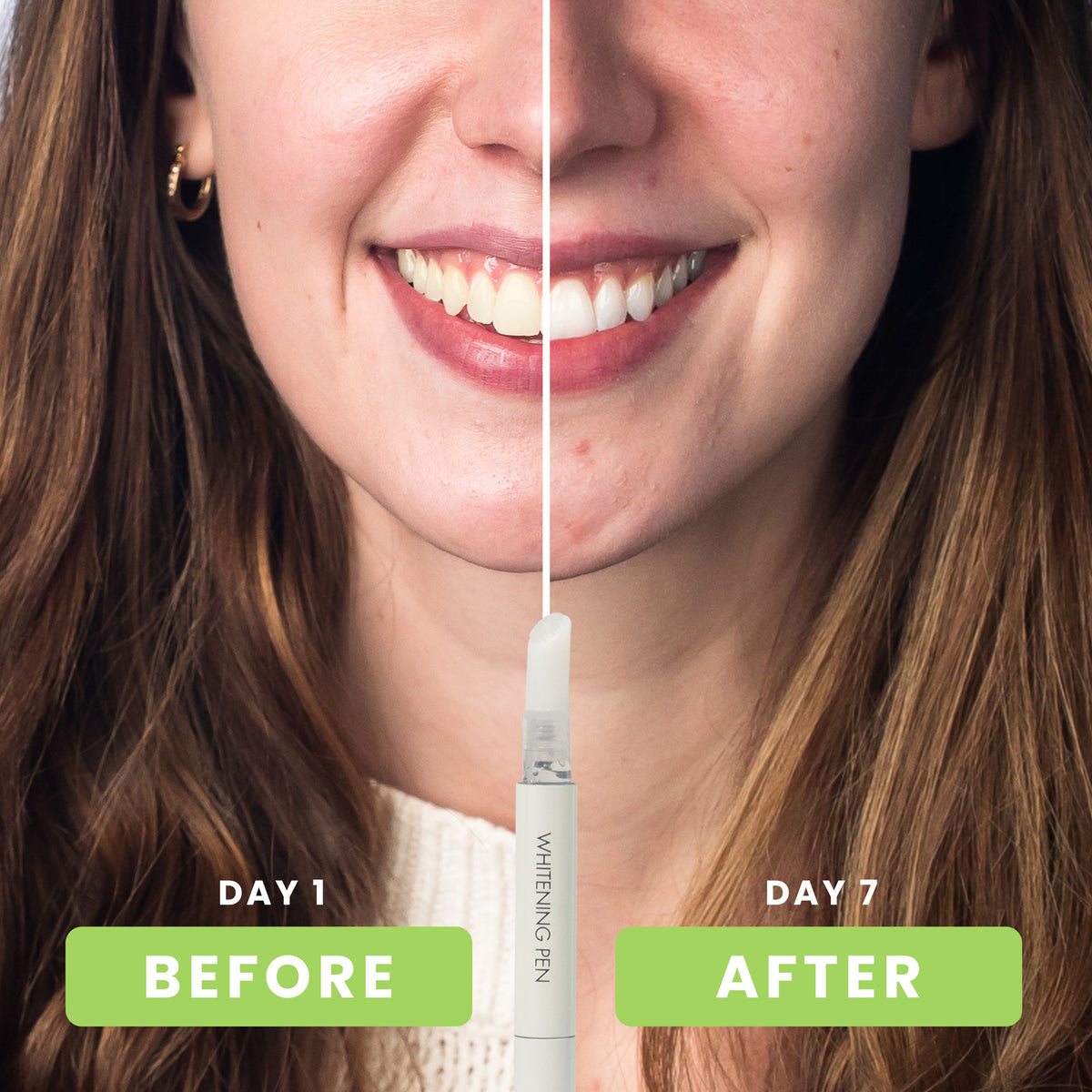 NEW Wireless Advanced Whitening System (With Hydrogen Peroxide)
